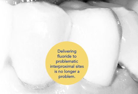 fluoride-delivering