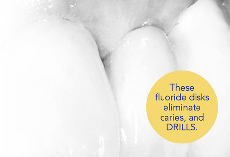 fluoride-disks