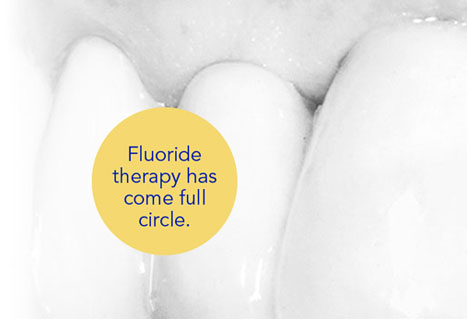 fluoride-therapy